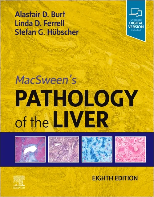 Coperta cărții "MacSween&#039;s Pathology of the Liver" de autor necunoscut