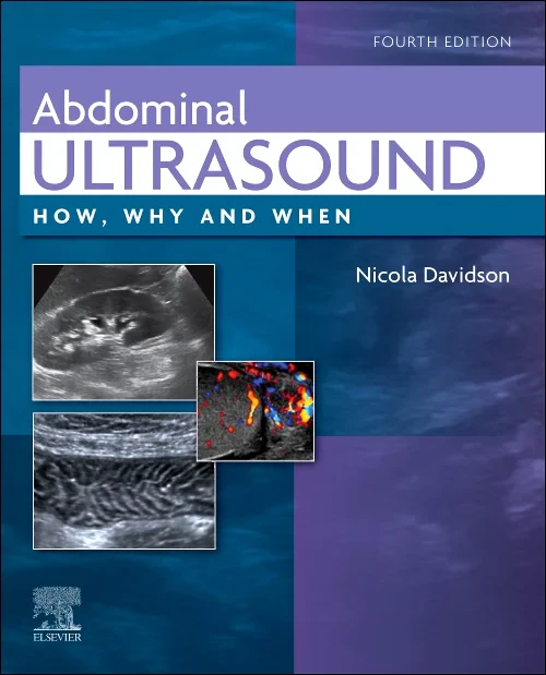 Coperta cărții "Abdominal Ultrasound" de autor necunoscut