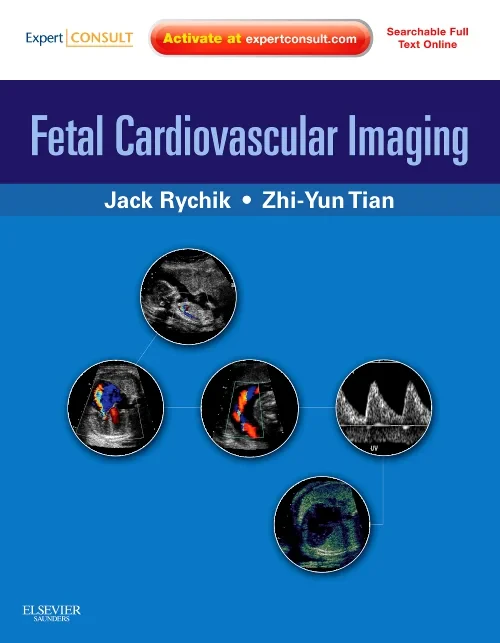 Coperta cărții "Fetal Cardiovascular Imaging: A Disease Based Approach" de autor necunoscut