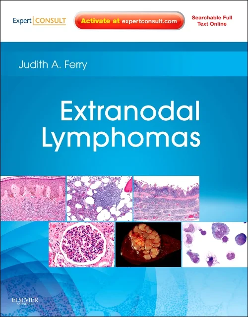 Coperta cărții "Extranodal Lymphomas" de autor necunoscut