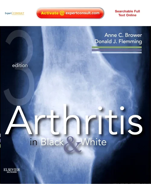 Coperta cărții "Arthritis in Black and White" de autor necunoscut