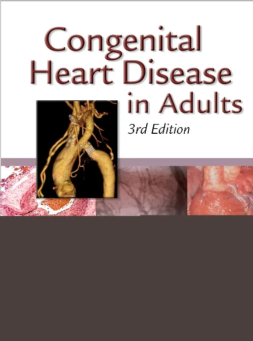 Coperta cărții "Congenital Heart Disease in Adults" de autor necunoscut