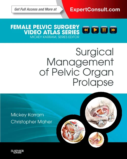 Coperta cărții "Surgical Management of Pelvic Organ Prolapse" de autor necunoscut