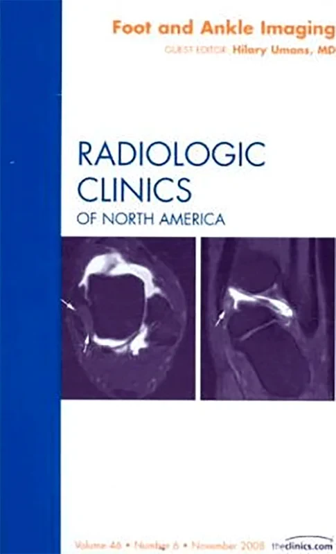 Coperta cărții "Foot and Ankle Imaging, An Issue of Radiologic Clinics" de autor necunoscut