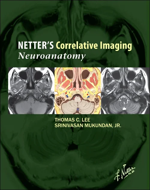 Coperta cărții "Netter’s Correlative Imaging: Neuroanatomy" de autor necunoscut