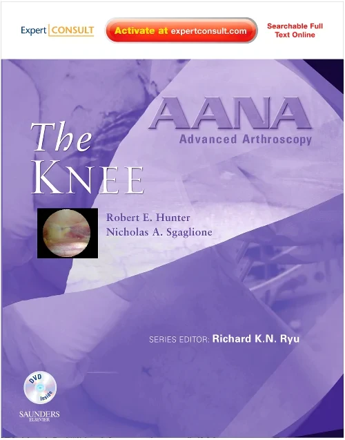 Coperta cărții "AANA Advanced Arthroscopy: The Knee" de autor necunoscut