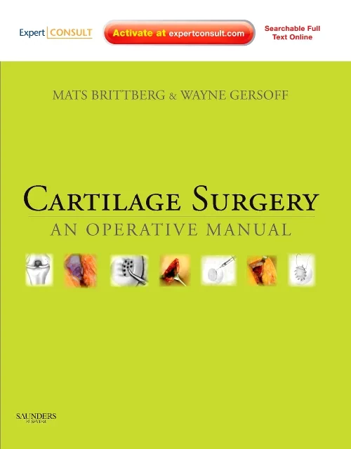 Coperta cărții "Cartilage Surgery" de autor necunoscut