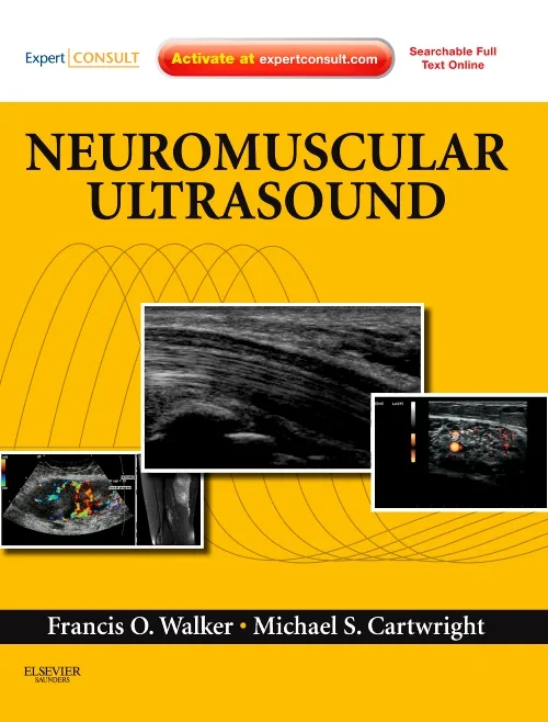 Coperta cărții "Neuromuscular Ultrasound" de autor necunoscut