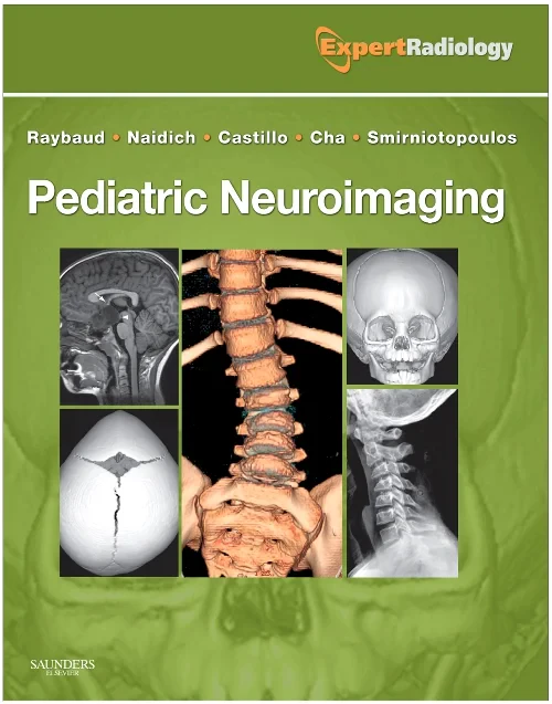 Coperta cărții "Pediatric Neuroimaging" de autor necunoscut