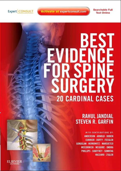 Coperta cărții "Best Evidence for Spine Surgery" de autor necunoscut