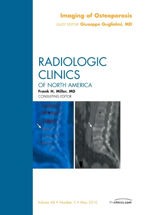 Coperta cărții "Imaging of Osteoporosis, An Issue of Radiologic Clinics of North America" de autor necunoscut