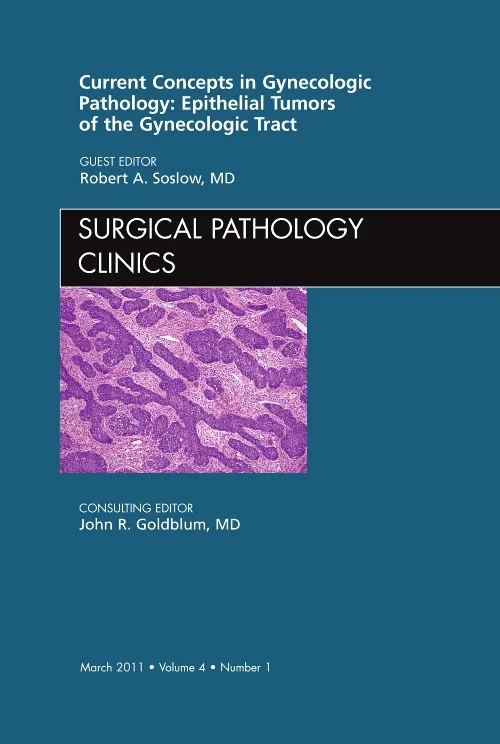 Coperta cărții "Current Concepts in Gynecologic Pathology: Epithelial Tumors of the Gynecologic Tract, An Issue of Surgical Pathology Clinics" de autor necunoscut