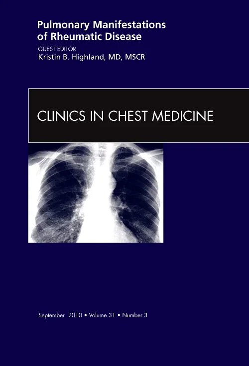 Coperta cărții "Pulmonary Manifestations of Rheumatic Disease, An Issue of Clinics in Chest Medicine" de autor necunoscut