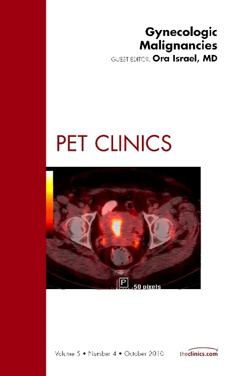 Coperta cărții "Gynecologic Malignancies, An Issue of PET Clinics" de autor necunoscut
