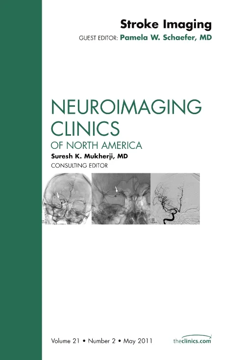 Coperta cărții "Stroke Imaging, An Issue of Neuroimaging Clinics" de autor necunoscut