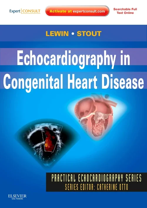 Coperta cărții "Echocardiography in Congenital Heart Disease" de autor necunoscut