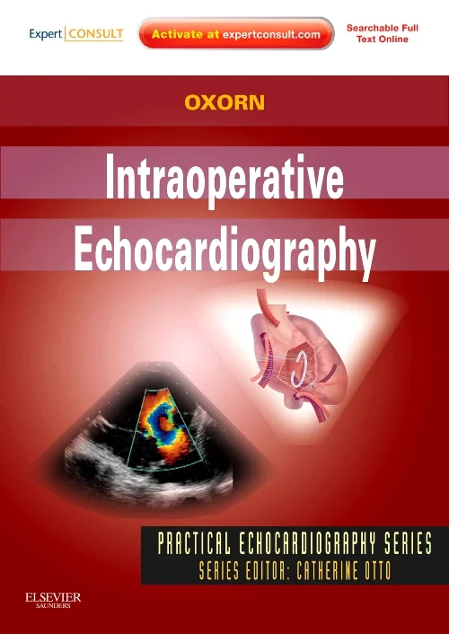 Coperta cărții "Intraoperative Echocardiography" de autor necunoscut