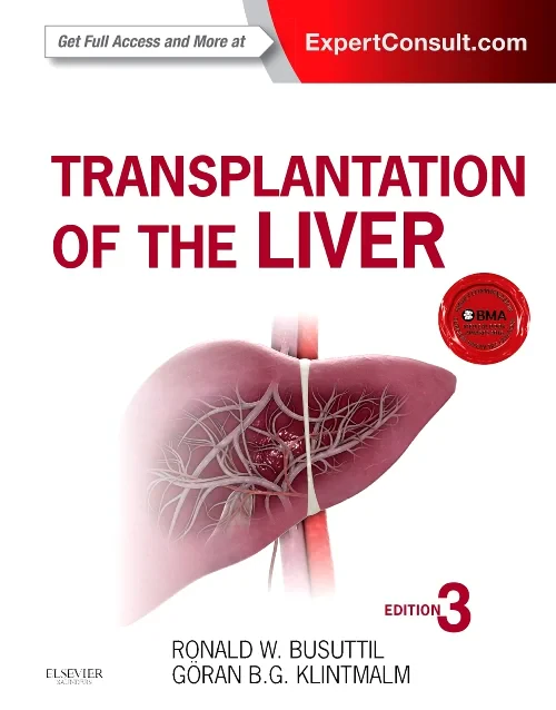 Coperta cărții "Transplantation of the Liver" de autor necunoscut