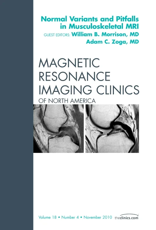 Coperta cărții "Normal Variants and Pitfalls in Musculoskeletal MRI, An Issue of Magnetic Resonance Imaging Clinics" de autor necunoscut