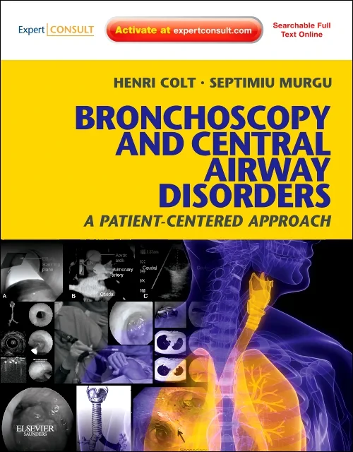 Coperta cărții "Bronchoscopy and Central Airway Disorders" de autor necunoscut