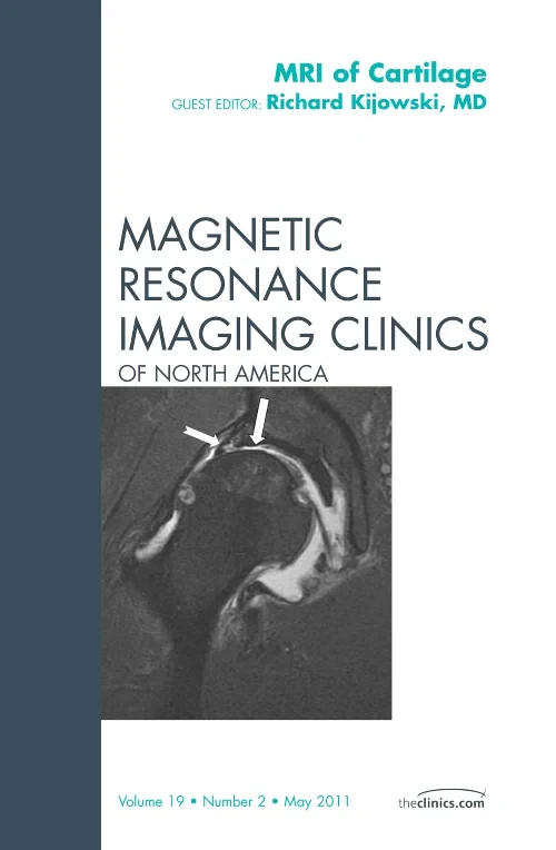 Coperta cărții "MRI of Cartilage, An Issue of Magnetic Resonance Imaging Clinics" de autor necunoscut