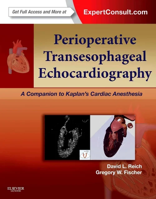 Coperta cărții "Perioperative Transesophageal Echocardiography" de autor necunoscut