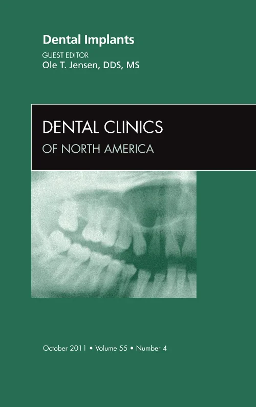 Coperta cărții "Dental Implants, An Issue of Dental Clinics" de autor necunoscut