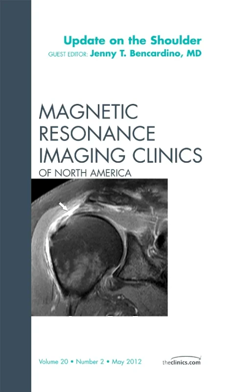 Coperta cărții "Update on the Shoulder, An Issue of Magnetic Resonance Imaging Clinics" de autor necunoscut