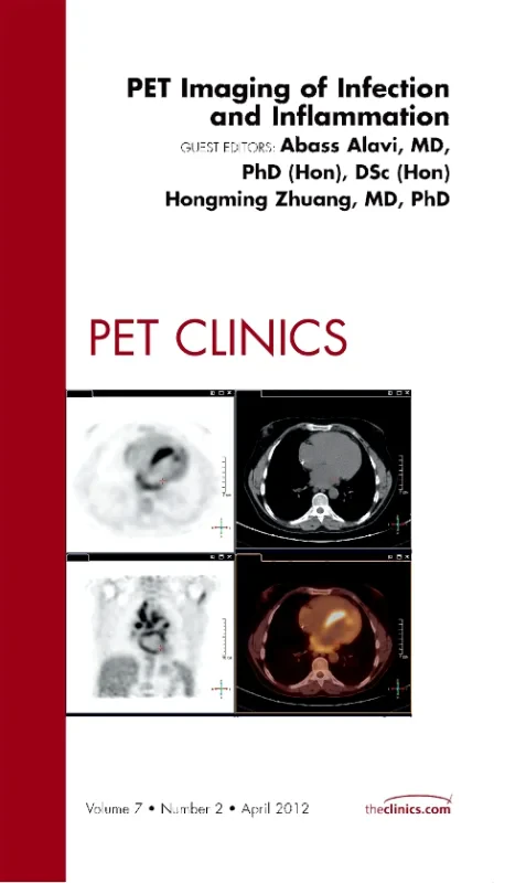 Coperta cărții "PET Imaging of Infection and Inflammation, An Issue of PET Clinics" de autor necunoscut