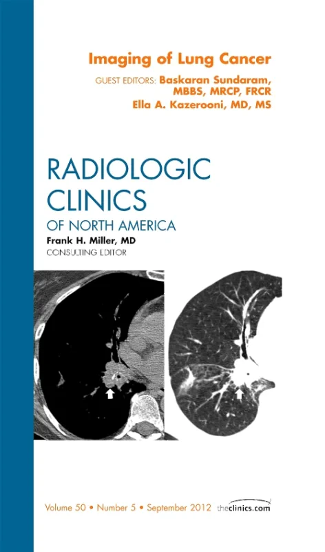 Coperta cărții "Imaging of Lung Cancer, An Issue of Radiologic Clinics of North America" de autor necunoscut
