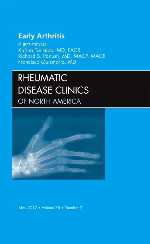 Coperta cărții "Early Arthritis, An Issue of Rheumatic Disease Clinics" de autor necunoscut
