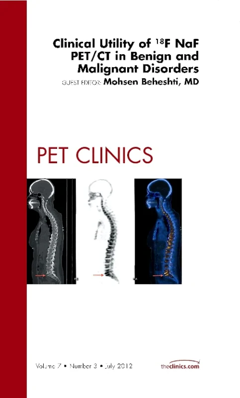 Coperta cărții "Clinical Utility of 18NaF PET/CT in Benign and Malignant Disorders, An Issue of PET Clinics" de autor necunoscut
