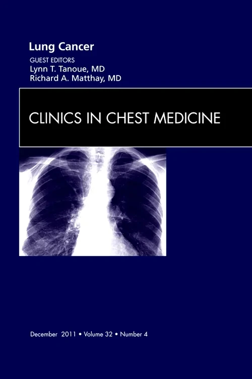 Coperta cărții "Lung Cancer, An Issue of Clinics in Chest Medicine" de autor necunoscut