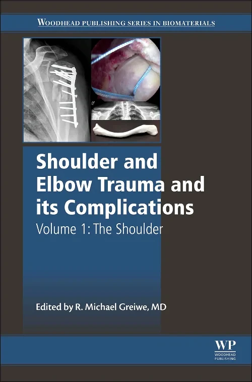 Coperta cărții "Shoulder and Elbow Trauma and its Complications" de autor necunoscut
