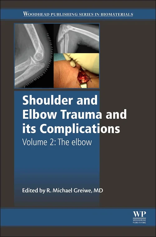 Coperta cărții "Shoulder and Elbow Trauma and its Complications" de autor necunoscut