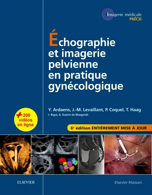 Coperta cărții "Échographie et imagerie pelvienne en pratique gynécologique" de autor necunoscut
