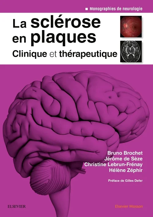 Coperta cărții "La sclérose en plaques - Clinique et thérapeutique" de autor necunoscut