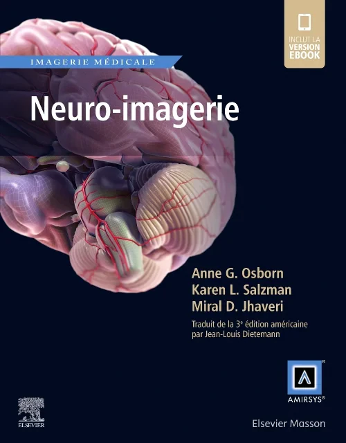 Coperta cărții "Neuro-imagerie" de autor necunoscut