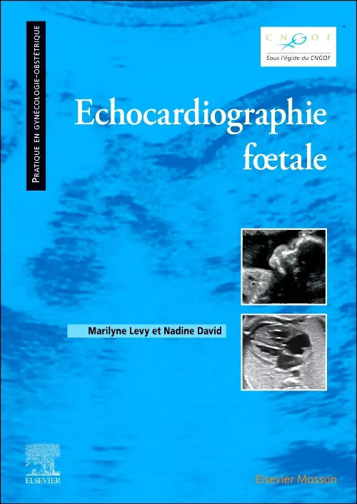Coperta cărții "Echocardiographie fœtale" de autor necunoscut