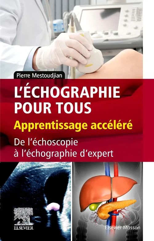 Coperta cărții "L&#039;échographie pour tous : apprentissage accéléré" de autor necunoscut