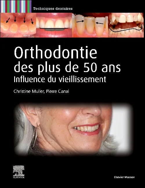 Coperta cărții "Orthodontie des plus de 50 ans" de autor necunoscut