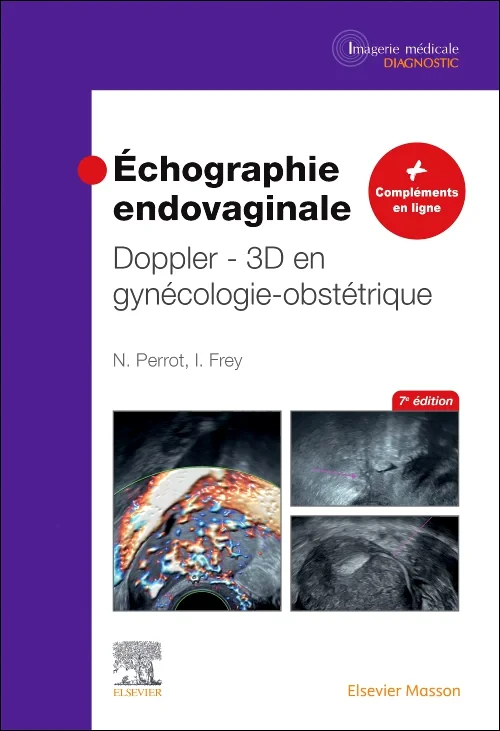 Coperta cărții "Échographie endovaginale Doppler - 3D" de autor necunoscut