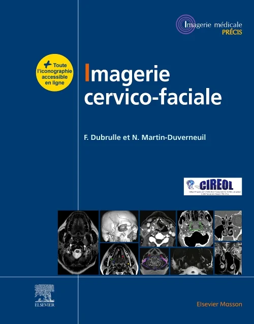 Coperta cărții "Imagerie cervicofaciale" de autor necunoscut