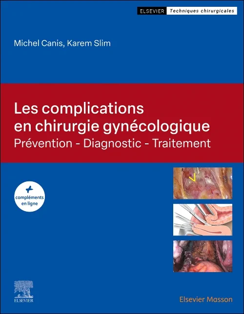 Coperta cărții "Les complications en chirurgie gynécologique" de autor necunoscut