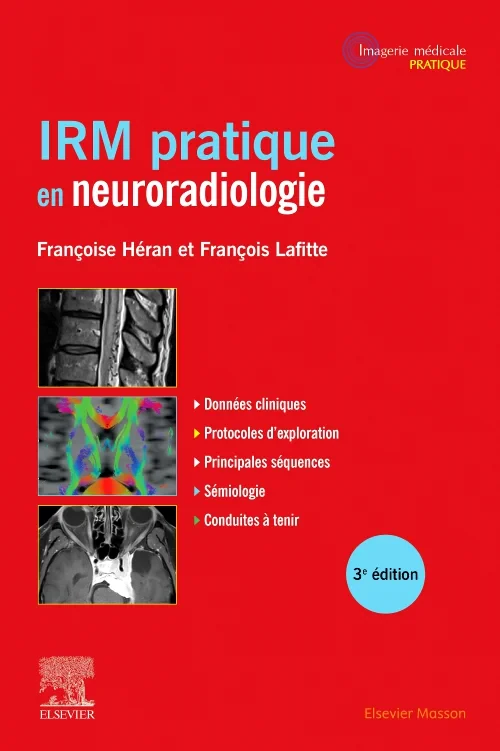 Coperta cărții "IRM pratique en neuroradiologie" de autor necunoscut