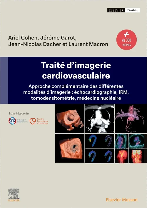 Coperta cărții "Traité d&#039;imagerie cardiovasculaire" de autor necunoscut