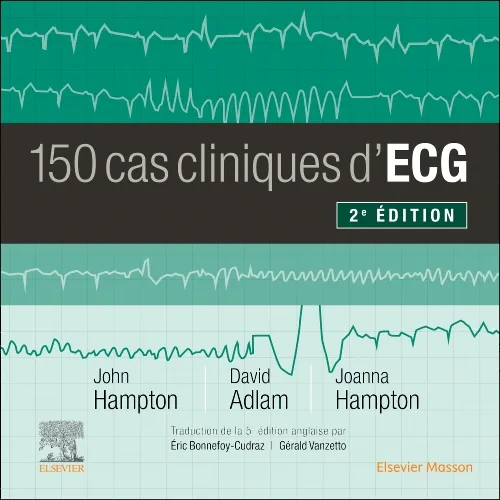 Coperta cărții "150 cas cliniques d&#039;ECG" de autor necunoscut