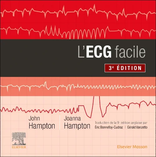 Coperta cărții "L&#039;ECG facile" de autor necunoscut