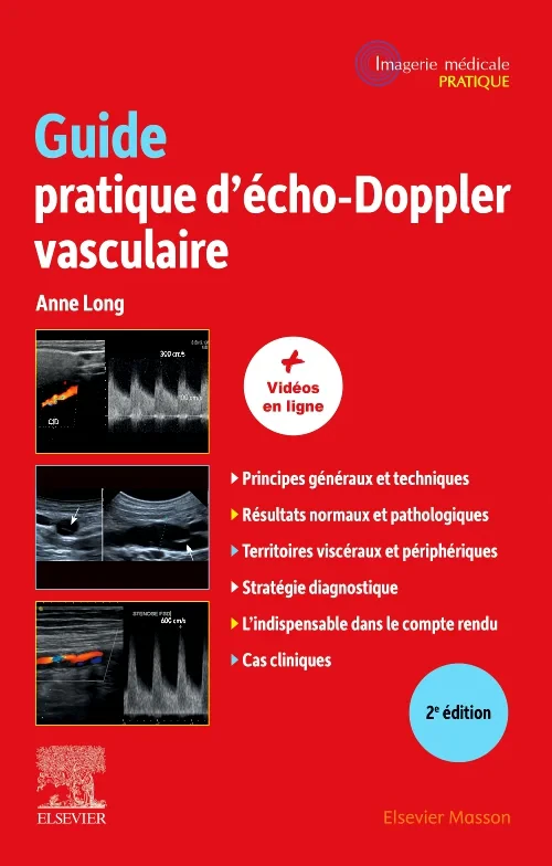 Coperta cărții "Guide pratique d&#039;écho-Doppler vasculaire" de autor necunoscut
