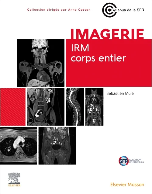 Coperta cărții "IRM corps entier" de autor necunoscut